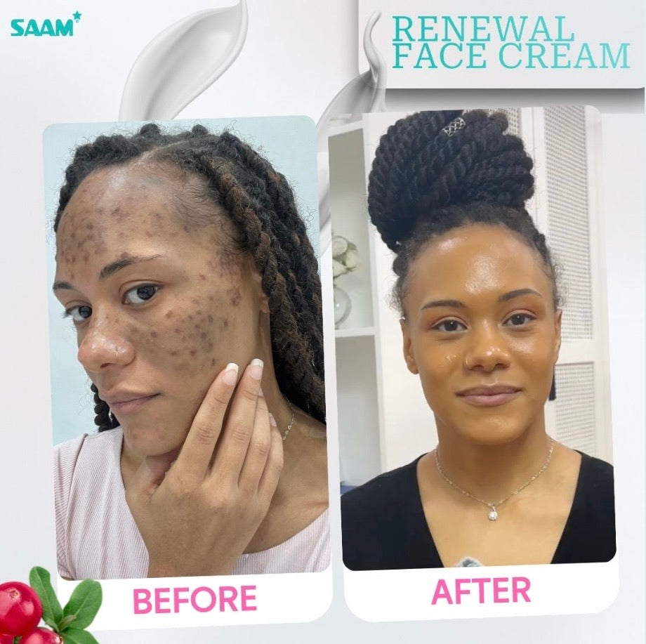 SAAM RENEWAL FACE CREAM